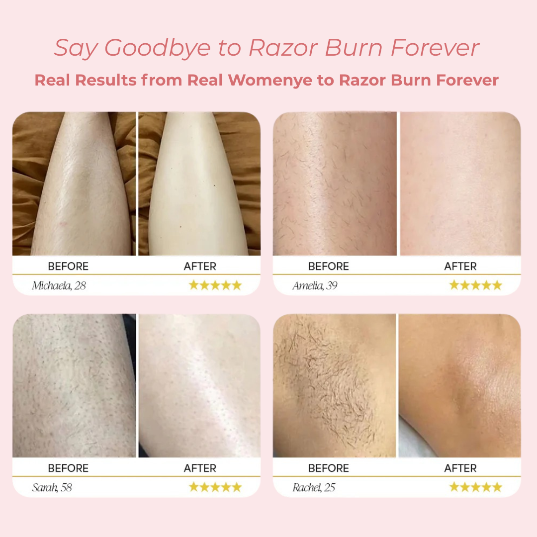 SilkGuard™ - 2-in-1 Painless Hair Trimmer