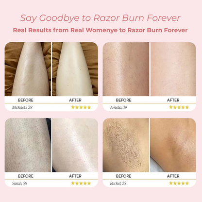 SilkGuard™ - 2-in-1 Painless Hair Trimmer